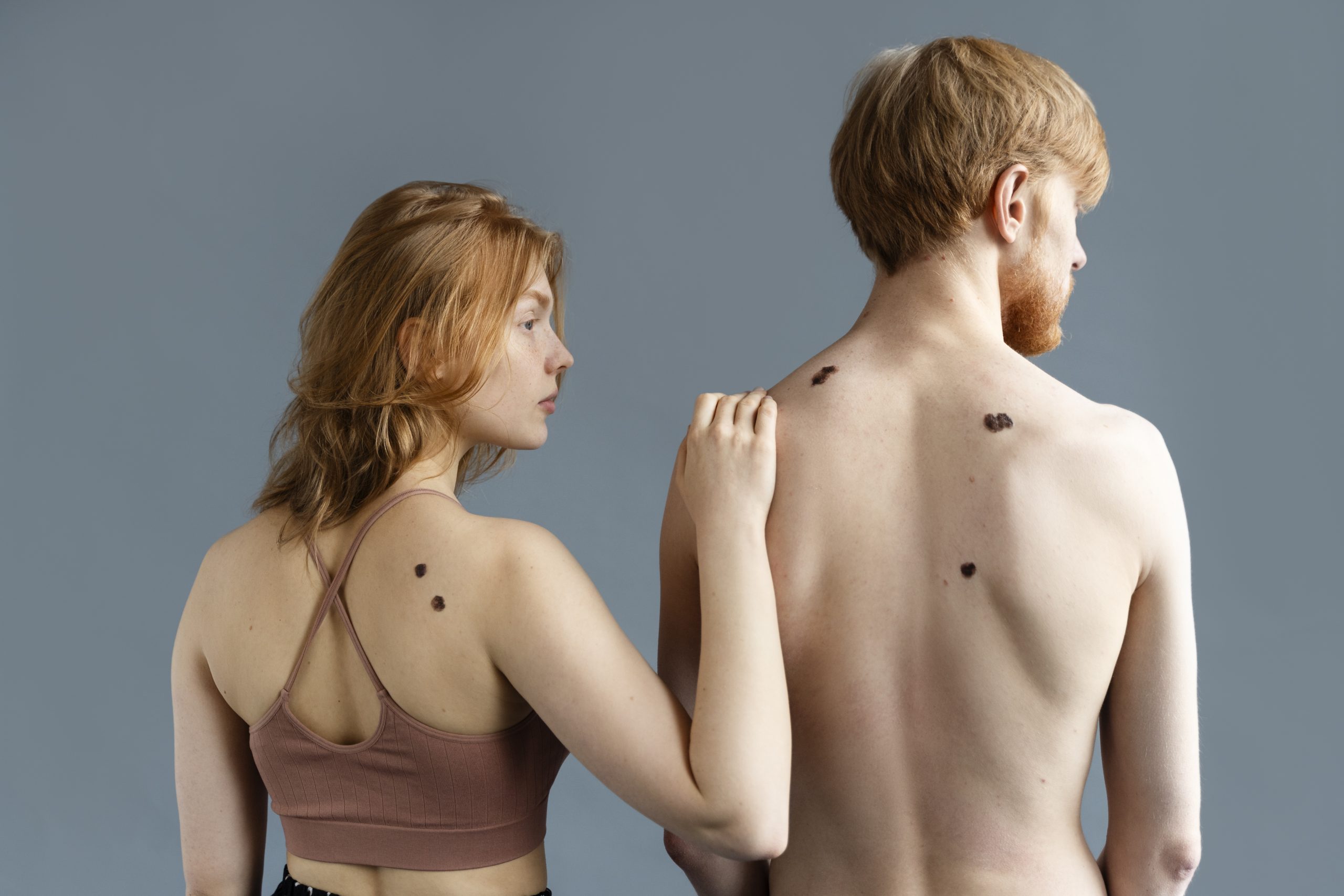 Nowa zmiana na Twoim ciele – dermatolog w OmegaMed Łazy